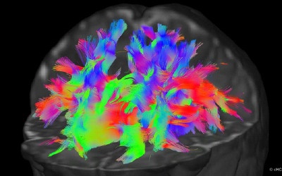 Desarrollo cognitivo prematuros